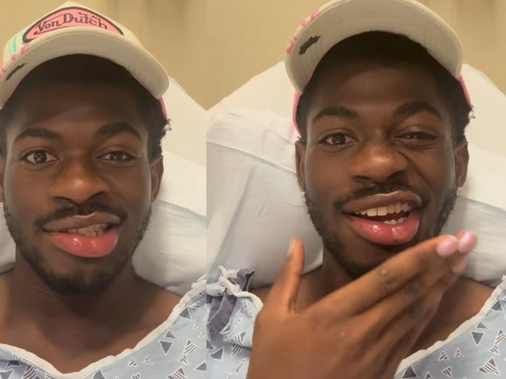 Lil Nas X sofre paralisia facial.